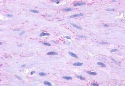 Immunohistochemistry-Paraffin: NK2R Antibody [NBP3-14421]