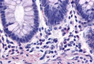 Immunohistochemistry-Paraffin: NK2R Antibody [NBP3-14421]