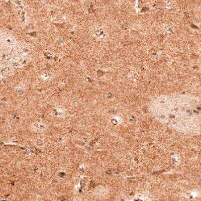 Immunohistochemistry-Paraffin: NK3R/TACR3/Neurokinin B Receptor Antibody [NBP1-82561]