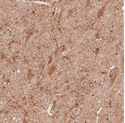 Immunohistochemistry-Paraffin: NK3R/TACR3/Neurokinin B Receptor Antibody [NBP1-82561]