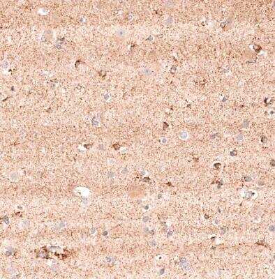 Immunohistochemistry-Paraffin: NK3R/TACR3/Neurokinin B Receptor Antibody [NBP1-82561]