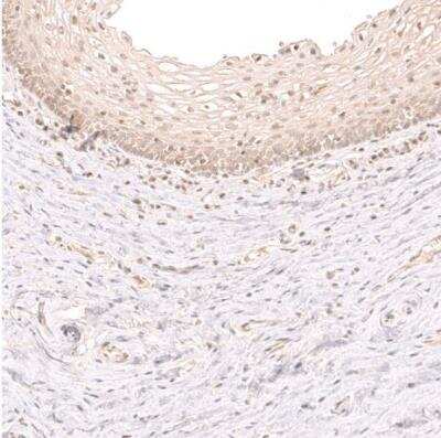 Immunohistochemistry-Paraffin: NK3R/TACR3/Neurokinin B Receptor Antibody [NBP1-82561]