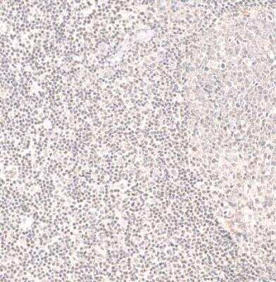 Immunohistochemistry-Paraffin: NK3R/TACR3/Neurokinin B Receptor Antibody [NBP1-82561]