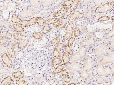Immunohistochemistry-Paraffin: NK3R/TACR3/Neurokinin B Receptor Antibody [NBP3-06055]