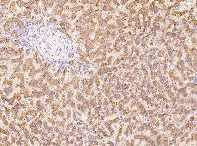 Immunohistochemistry-Paraffin: NK3R/TACR3/Neurokinin B Receptor Antibody [NBP3-06055]