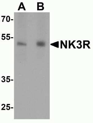 Western Blot: NK3R/TACR3/Neurokinin B Receptor AntibodyBSA Free [NBP2-82076]