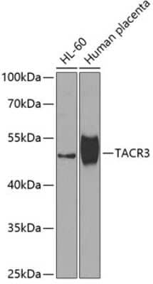 Western Blot: NK3R/TACR3/Neurokinin B Receptor AntibodyBSA Free [NBP2-93024]