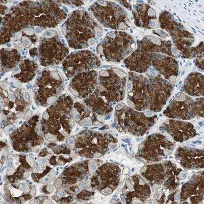 Immunohistochemistry-Paraffin: NKAIN1 Antibody [NBP1-90463]