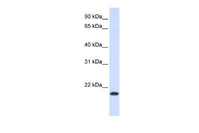 Western Blot: NKAIN1 Antibody [NBP2-83274]