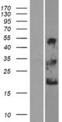 Western Blot: NKAIN1 Overexpression Lysate [NBP2-06328]