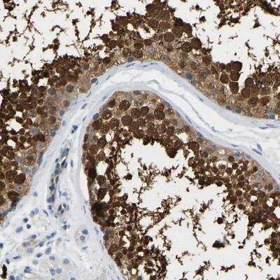 Immunohistochemistry: NKAIN3 Antibody [NBP2-14491]