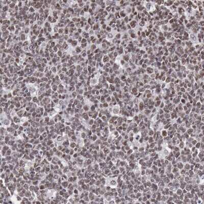 Immunohistochemistry-Paraffin: NKAP Antibody [NBP1-82117]