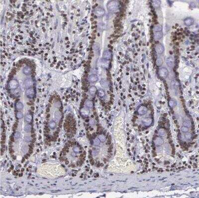 Immunohistochemistry-Paraffin: NKAP Antibody [NBP1-82117]
