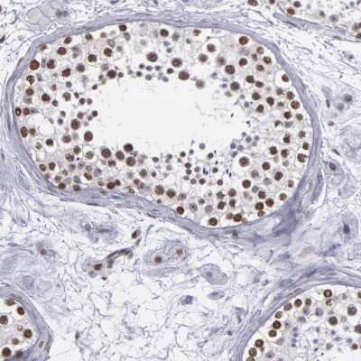 Immunohistochemistry-Paraffin: NKAP Antibody [NBP1-82117]