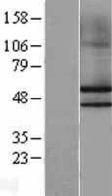 Western Blot: NKAP Overexpression Lysate [NBL1-13651]