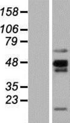 Western Blot: NKAPL Overexpression Lysate [NBP2-08816]