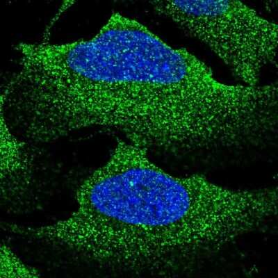 Immunocytochemistry/ Immunofluorescence: NKCC1/SLC12A2 Antibody [NBP2-56180]