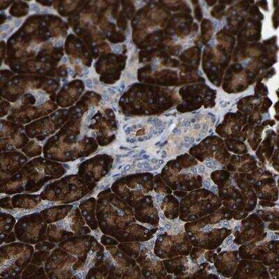 Immunohistochemistry-Paraffin: NKCC1/SLC12A2 Antibody [NBP1-89928]