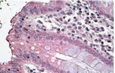 Immunohistochemistry-Paraffin: NKCC1/SLC12A2 Antibody [NBP1-52148]