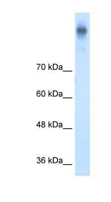 Western Blot: NKCC1/SLC12A2 Antibody [NBP1-59430]