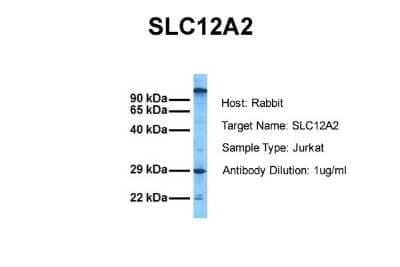 Western Blot: NKCC1/SLC12A2 Antibody [NBP1-59430]