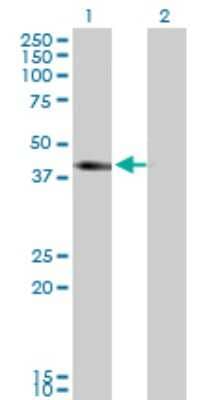 Western Blot: NKCC2/SLC12A1 Antibody (4H4) [H00006557-M03]