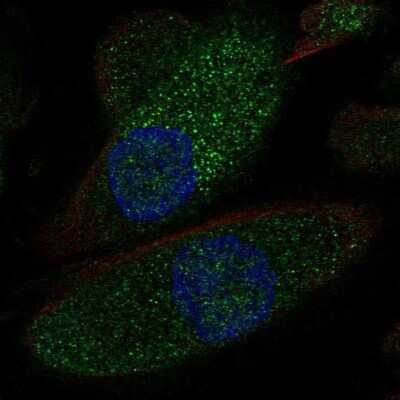 Immunocytochemistry/ Immunofluorescence: NKCC2/SLC12A1 Antibody [NBP1-80993]