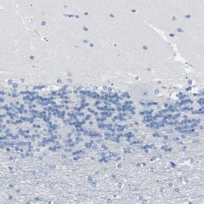 Immunohistochemistry-Paraffin: NKCC2/SLC12A1 Antibody [NBP1-80993]