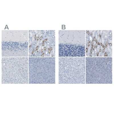 Immunohistochemistry-Paraffin: NKCC2/SLC12A1 Antibody [NBP1-80993]
