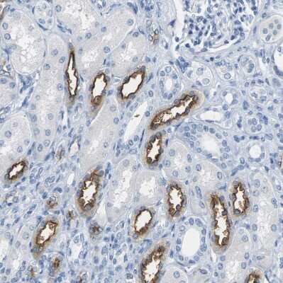 Immunohistochemistry-Paraffin: NKCC2/SLC12A1 Antibody [NBP1-80993]