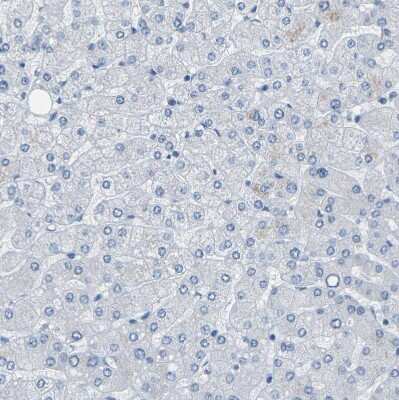 Immunohistochemistry-Paraffin: NKCC2/SLC12A1 Antibody [NBP1-80993]