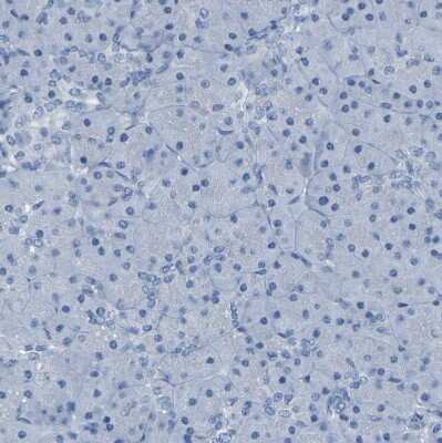 Immunohistochemistry-Paraffin: NKCC2/SLC12A1 Antibody [NBP1-80993]