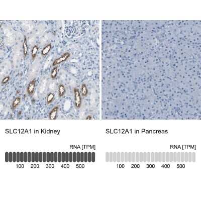 Immunohistochemistry-Paraffin: NKCC2/SLC12A1 Antibody [NBP1-80993]