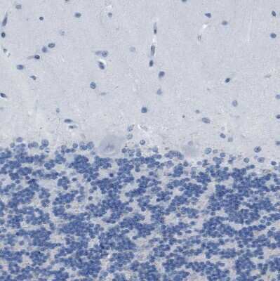Immunohistochemistry-Paraffin: NKCC2/SLC12A1 Antibody [NBP1-82559]