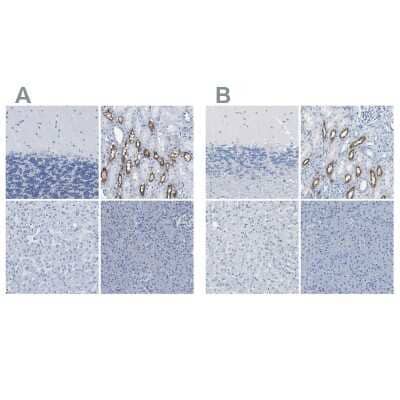 Immunohistochemistry-Paraffin: NKCC2/SLC12A1 Antibody [NBP1-82559]