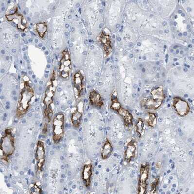 Immunohistochemistry-Paraffin: NKCC2/SLC12A1 Antibody [NBP1-82559]