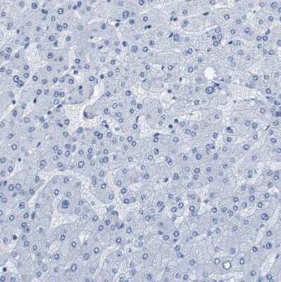 Immunohistochemistry-Paraffin: NKCC2/SLC12A1 Antibody [NBP1-82559]