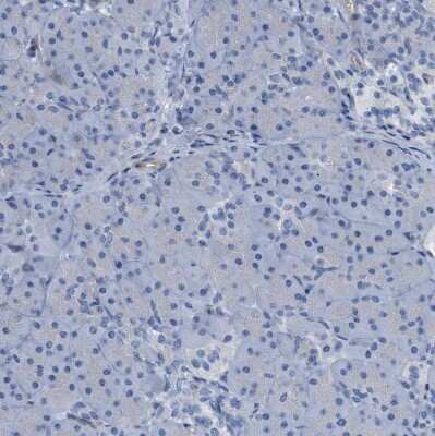 Immunohistochemistry-Paraffin: NKCC2/SLC12A1 Antibody [NBP1-82559]
