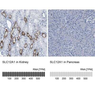 Immunohistochemistry-Paraffin: NKCC2/SLC12A1 Antibody [NBP1-82559]