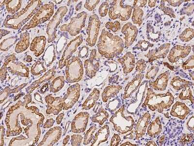 Immunohistochemistry-Paraffin: NKCC2/SLC12A1 Antibody [NBP2-98480]