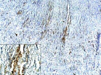 Immunohistochemistry-Paraffin: NKCC2/SLC12A1 Antibody [NBP3-12228]