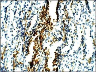 Immunohistochemistry-Paraffin: NKCC2/SLC12A1 Antibody [NBP3-12228]