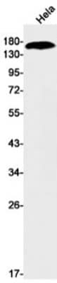 Western Blot: NKCC2/SLC12A1 Antibody (S07-5D1) [NBP3-19717]