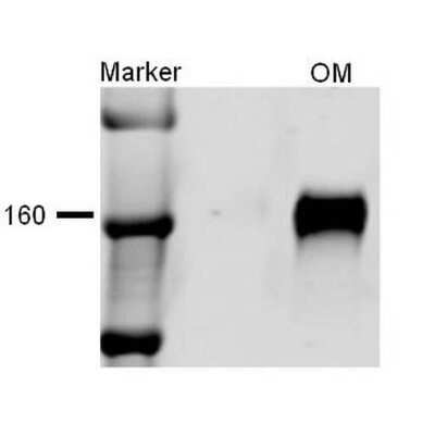 Western Blot: NKCC2/SLC12A1 Antibody [NBP1-44269]