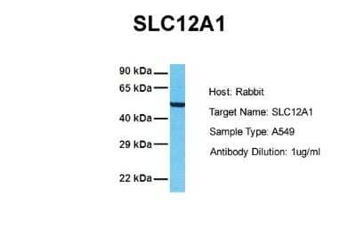 Western Blot: NKCC2/SLC12A1 Antibody [NBP1-57622]