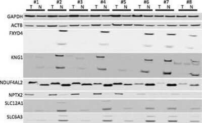 Western Blot: NKCC2/SLC12A1 Antibody [NBP1-80993]