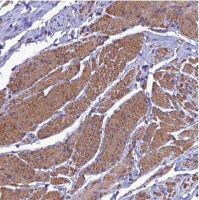 Immunohistochemistry: NKD1 Antibody [NBP2-30988]