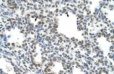 Immunohistochemistry-Paraffin: NKD1 Antibody [NBP1-55270]