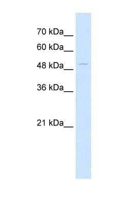 Western Blot: NKD1 Antibody [NBP1-55270]