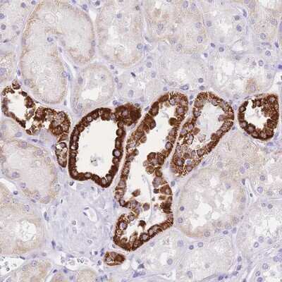 Immunohistochemistry-Paraffin: NKD2 Antibody [NBP2-13658]